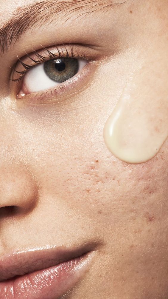 8 Hbitos que empeoran el acn